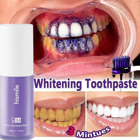 Hismile V34 Teeth Whitener (SA)