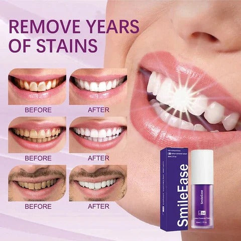 Hismile V34 Teeth Whitener (SA)