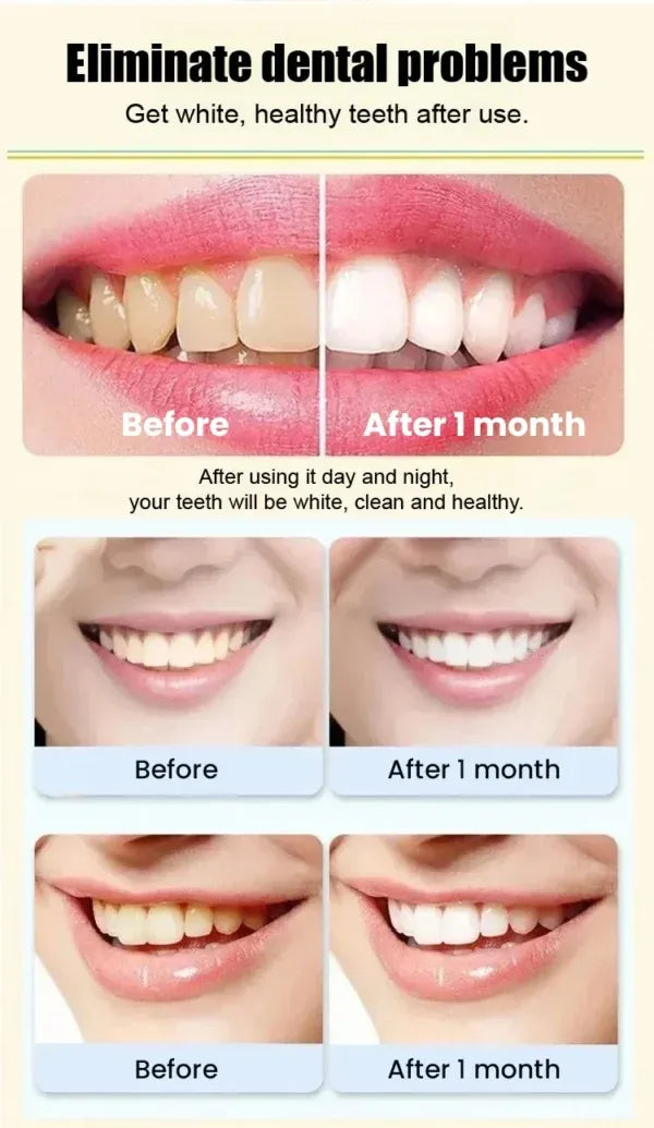 Probiotic-Rapid Whitening Toothpaste Sp4